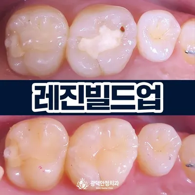 광덕안정치과의원 청량리점 — 업체가 네이버 플레이스에 올린 사진 2
