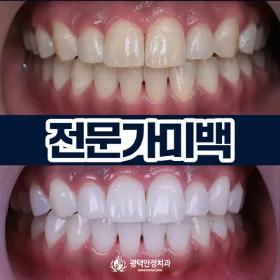 광덕안정치과의원 청량리점 — 업체가 네이버 플레이스에 올린 사진 3