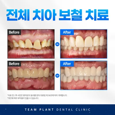 팀플란트치과의원 — 업체가 네이버 플레이스에 올린 사진 3