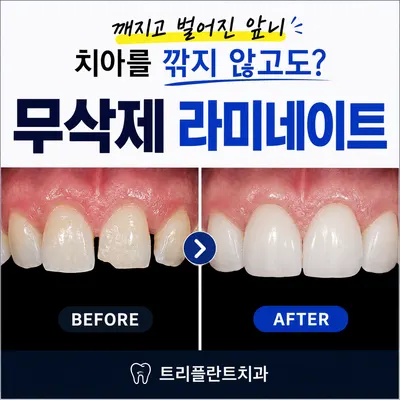 트리플란트치과의원 — 업체가 네이버 플레이스에 올린 사진 2