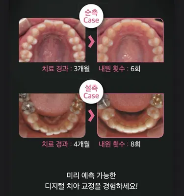 불꽃치과의원강북점 — 업체가 네이버 플레이스에 올린 사진 2