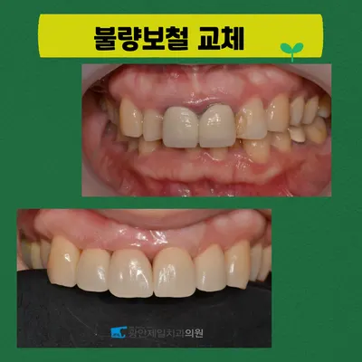 광안제일치과의원 — 업체가 네이버 플레이스에 올린 사진 3