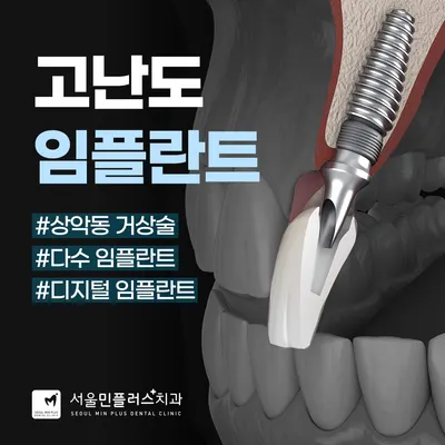 서울민플러스치과의원 — 업체가 네이버 플레이스에 올린 사진 2