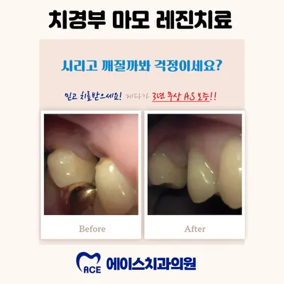 에이스치과의원 영등포문래동점 — 업체가 네이버 플레이스에 올린 사진 3