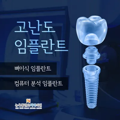 뉴욕플란트치과의원 — 업체가 네이버 플레이스에 올린 사진 2