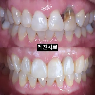 정성치과의원 — 업체가 네이버 플레이스에 올린 사진 2