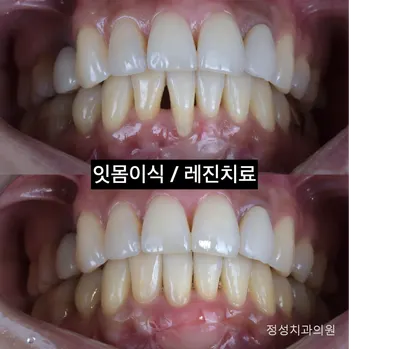 정성치과의원 — 업체가 네이버 플레이스에 올린 사진 3