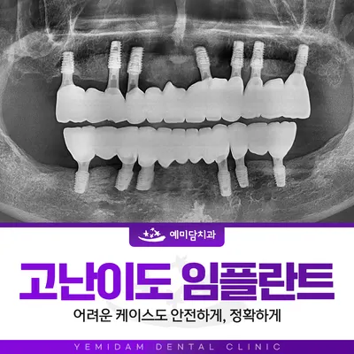 예미담치과의원 — 업체가 네이버 플레이스에 올린 사진 2
