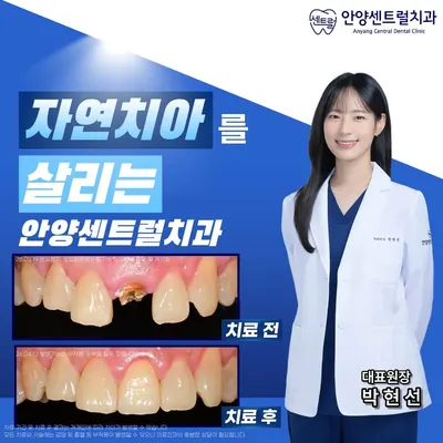 안양센트럴치과의원 — 업체가 네이버 플레이스에 올린 사진 3