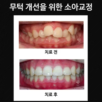 휴플러스치과의원 — 업체가 네이버 플레이스에 올린 사진 3