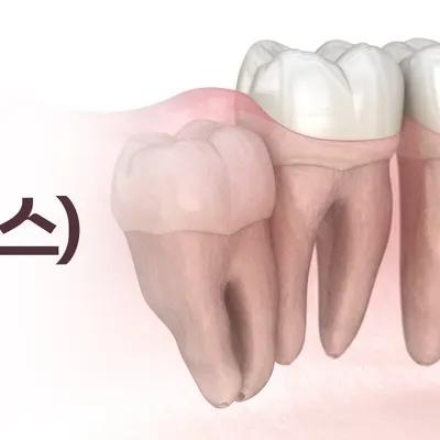 서울백치과의원 — 업체가 네이버 플레이스에 올린 사진 3