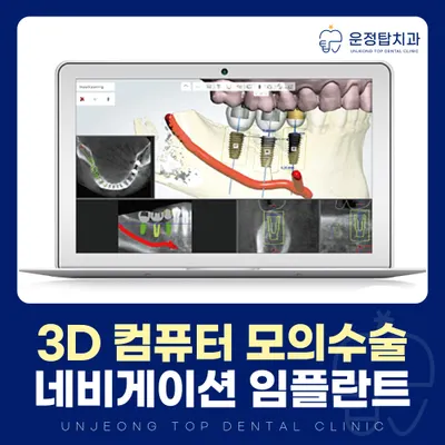 운정탑치과의원 — 업체가 네이버 플레이스에 올린 사진 3