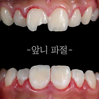 레진치과의원 — 업체가 네이버 플레이스에 올린 사진 1