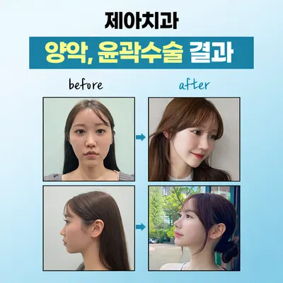 제아치과의원 — 업체가 네이버 플레이스에 올린 사진 3
