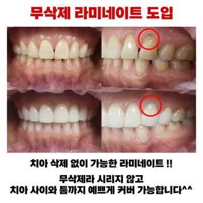 연세수치과의원 — 업체가 네이버 플레이스에 올린 사진 2