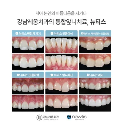 강남레옹치과의원 — 업체가 네이버 플레이스에 올린 사진 2