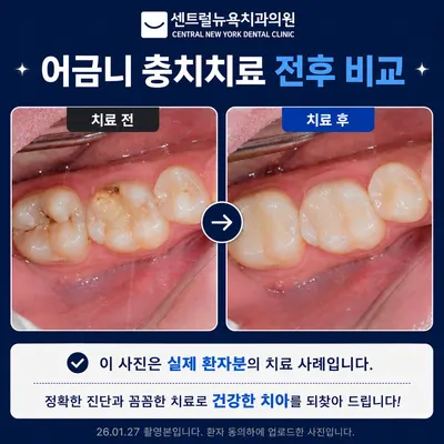 센트럴뉴욕치과의원 — 업체가 네이버 플레이스에 올린 사진 3