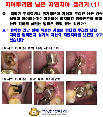 박강석치과의원 — 업체가 네이버 플레이스에 올린 사진 3