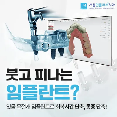 서울민플러스치과의원 — 업체가 네이버 플레이스에 올린 사진 3