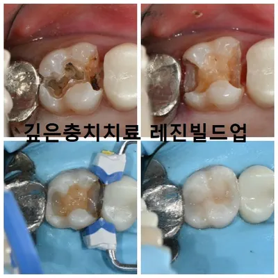 더편한치과의원 — 업체가 네이버 플레이스에 올린 사진 2