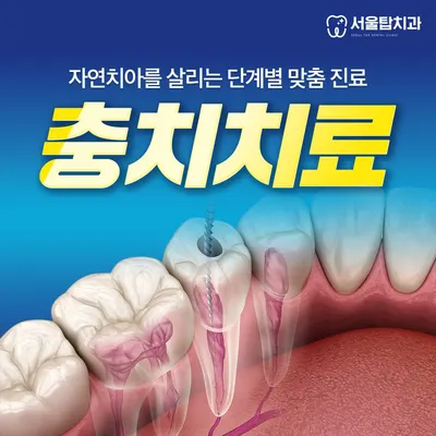 서울탑치과의원 — 업체가 네이버 플레이스에 올린 사진 3