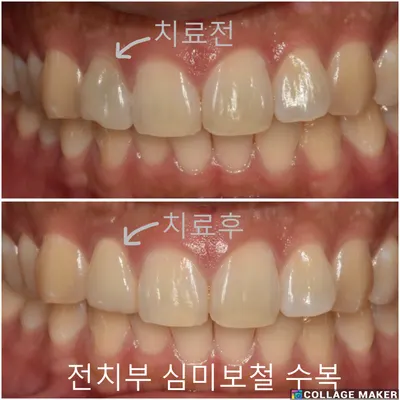 서울바른플란트치과의원 — 업체가 네이버 플레이스에 올린 사진 2