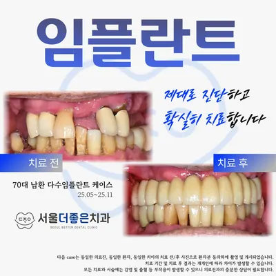 서울더좋은치과의원 — 업체가 네이버 플레이스에 올린 사진 3