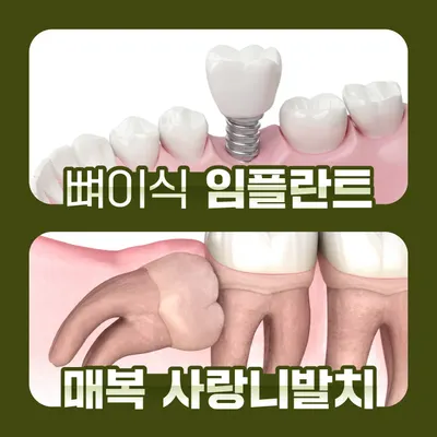 서울J플란트치과의원 — 업체가 네이버 플레이스에 올린 사진 2