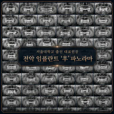 서울바른플란트치과의원 — 업체가 네이버 플레이스에 올린 사진 2