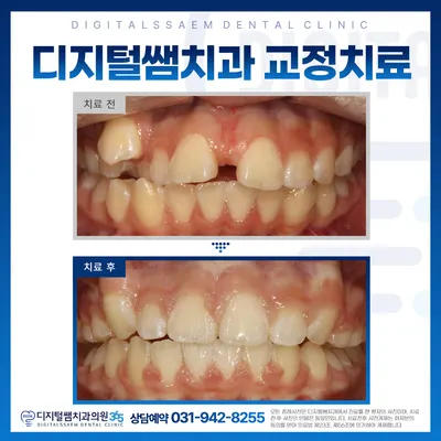 디지털쌤치과의원 — 업체가 네이버 플레이스에 올린 사진 3