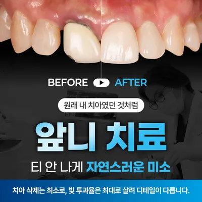 서울진이치과의원 — 업체가 네이버 플레이스에 올린 사진 2