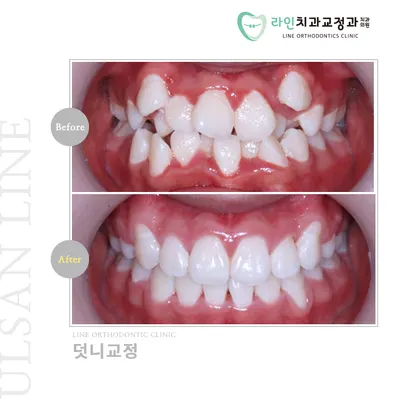 라인치과교정과치과의원 — 업체가 네이버 플레이스에 올린 사진 3