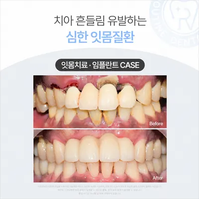 루틴치과의원 — 업체가 네이버 플레이스에 올린 사진 3