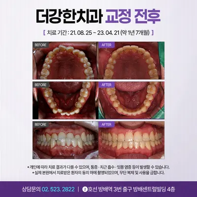 더강한치과의원 방배 — 업체가 네이버 플레이스에 올린 사진 3