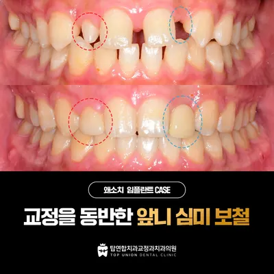 탑연합치과교정과 치과의원 — 업체가 네이버 플레이스에 올린 사진 2