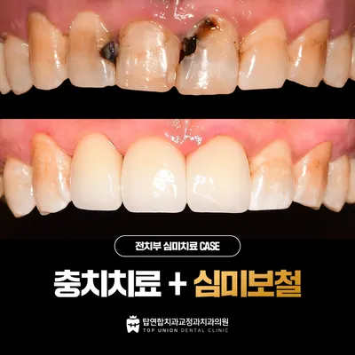 탑연합치과교정과 치과의원 — 업체가 네이버 플레이스에 올린 사진 3