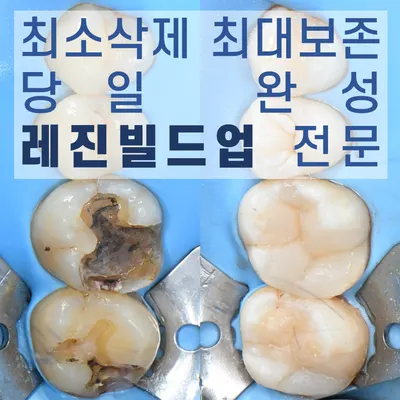 청담세브란스치과의원 — 업체가 네이버 플레이스에 올린 사진 2