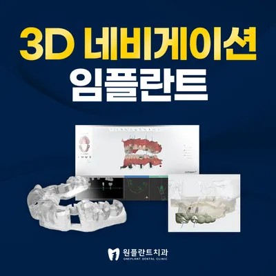 원플란트치과의원 — 업체가 네이버 플레이스에 올린 사진 3