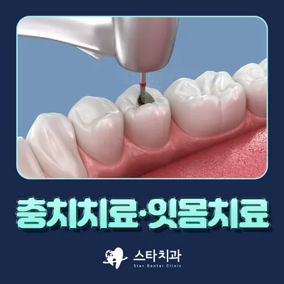 스타치과의원 — 업체가 네이버 플레이스에 올린 사진 3
