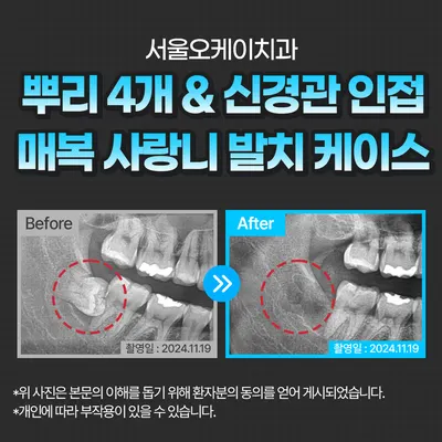 서울오케이치과의원 별가람점 — 업체가 네이버 플레이스에 올린 사진 3