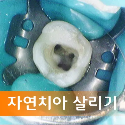 리버스치과의원 — 업체가 네이버 플레이스에 올린 사진 2