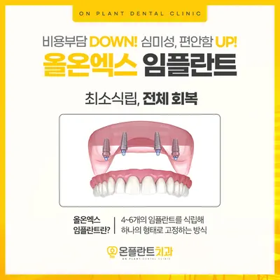 온플란트치과의원 — 업체가 네이버 플레이스에 올린 사진 2