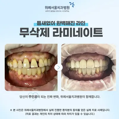위례서울치과병원 — 업체가 네이버 플레이스에 올린 사진 3