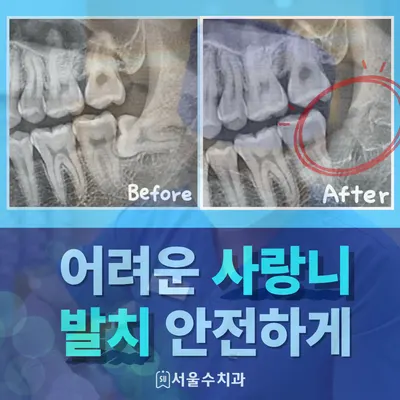 서울수치과의원 — 업체가 네이버 플레이스에 올린 사진 3
