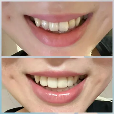 미소치과기공소 — 업체가 네이버 플레이스에 올린 사진 1