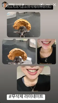 미소치과기공소 — 업체가 네이버 플레이스에 올린 사진 2
